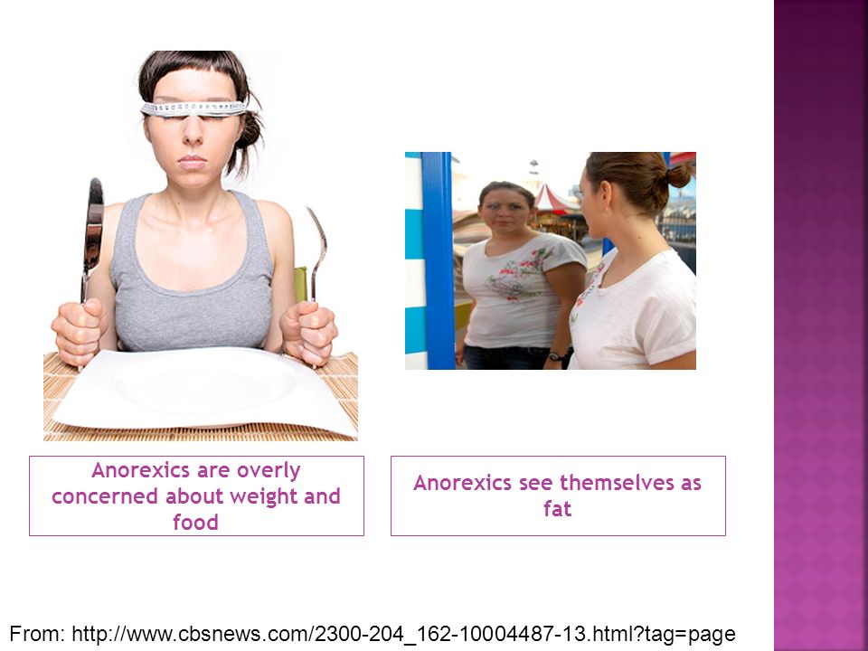 Anorexics are overly concerned about weight and food Anorexics see themselves as fat From:   tag=page