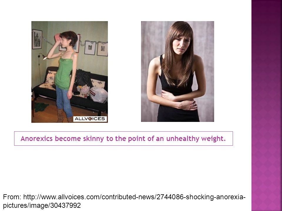 Anorexics become skinny to the point of an unhealthy weight.