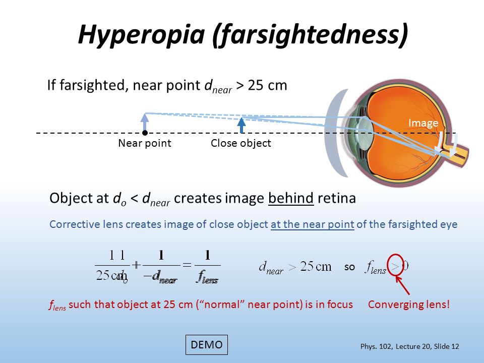 Phys 102 Lecture The Eye Corrective Lenses Ppt Download