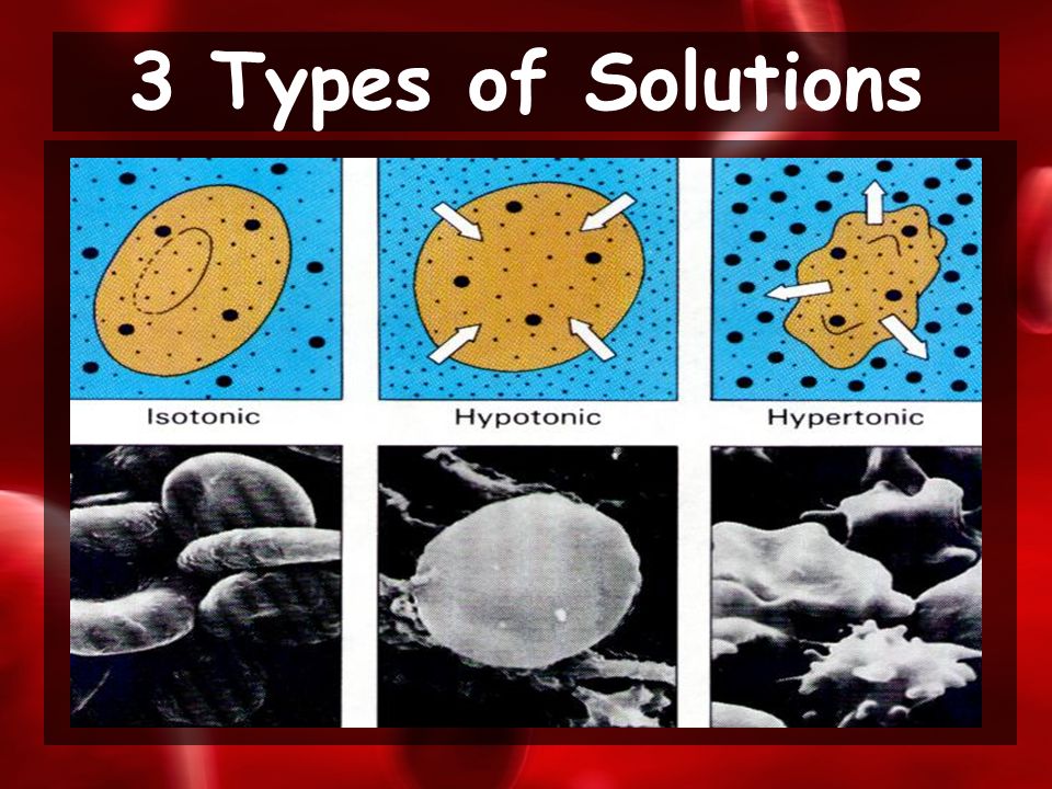 3 Types of Solutions