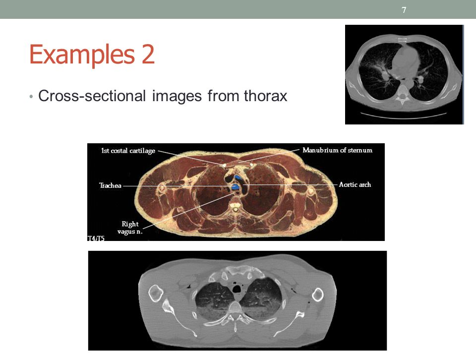 Examples MRI image, human skull Cross-sectional CT image of human brains 6