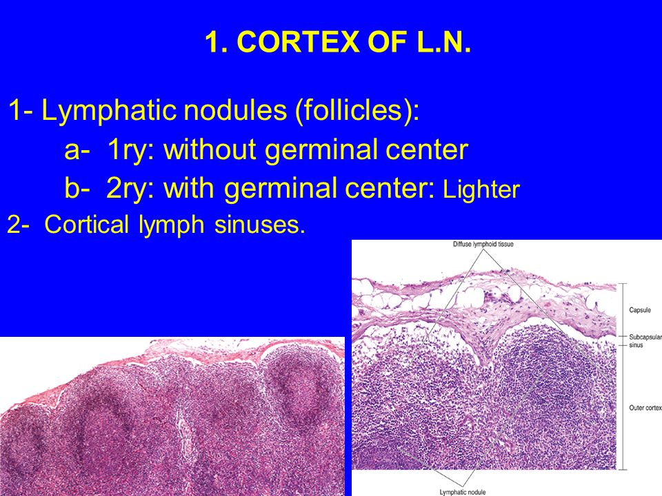 LYMPHOID TISSUE Lymphocyte. LYMPHOID TISSUE A) Diffuse lymphoid tissue B)  Encapsulated lymphoid organs: 1- Lymph nodes. 2- Spleen. 3- Tonsils (are  incompletely. - ppt download