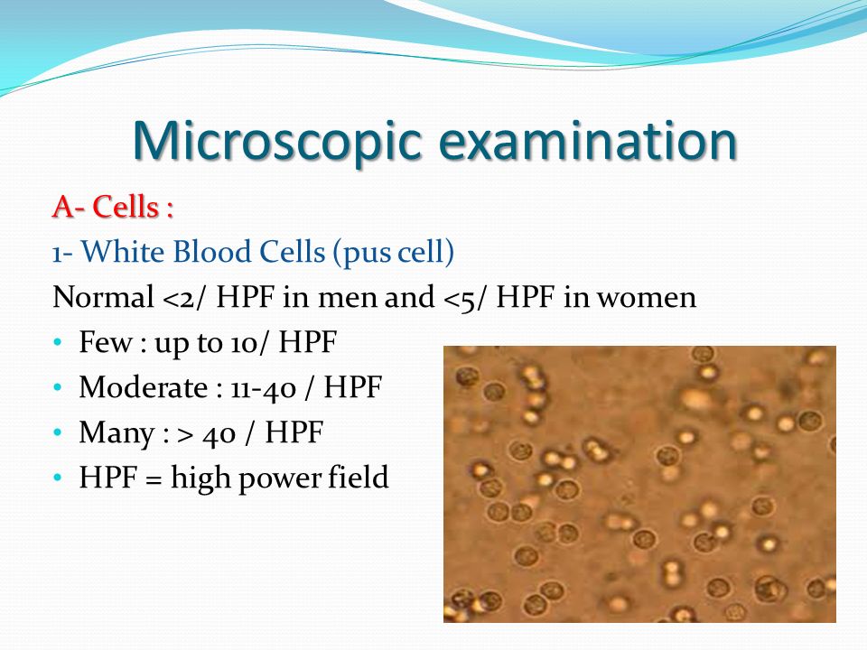 Normal Urine Test Results Chart Pus Cells