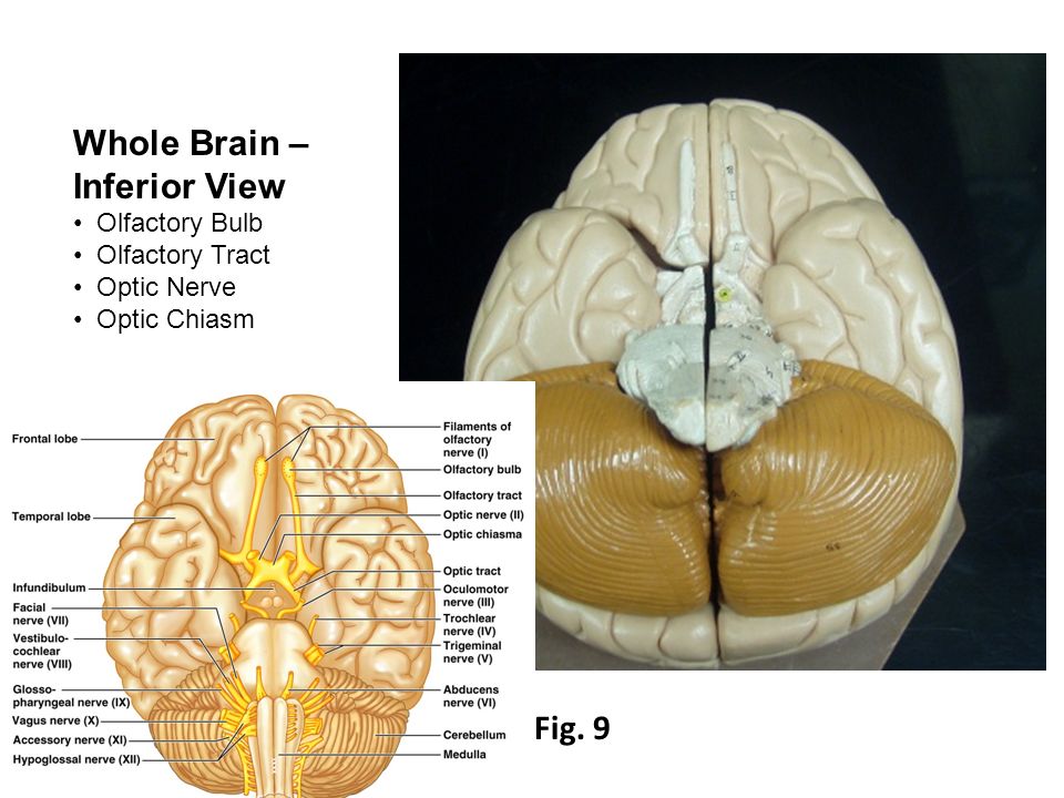 Gross Anatomy Of The Brain And Cranial Nerves Lab Exercise