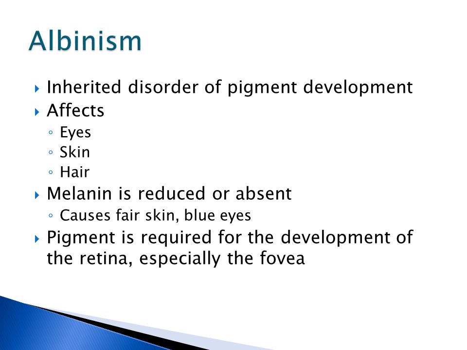  Inherited disorder of pigment development  Affects ◦ Eyes ◦ Skin ◦ Hair  Melanin is reduced or absent ◦ Causes fair skin, blue eyes  Pigment is required for the development of the retina, especially the fovea