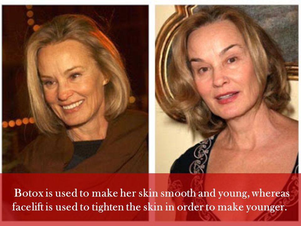 Jessica Lange Plastic Surgery. Jessica Lange's acting career is still  increasing since recently won an Emmy Award for her role in American Horror  Story. - ppt download