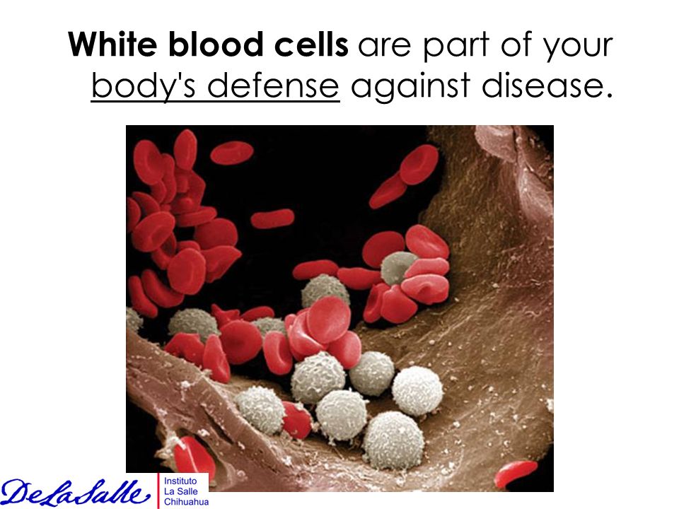 White blood cells are part of your body s defense against disease.
