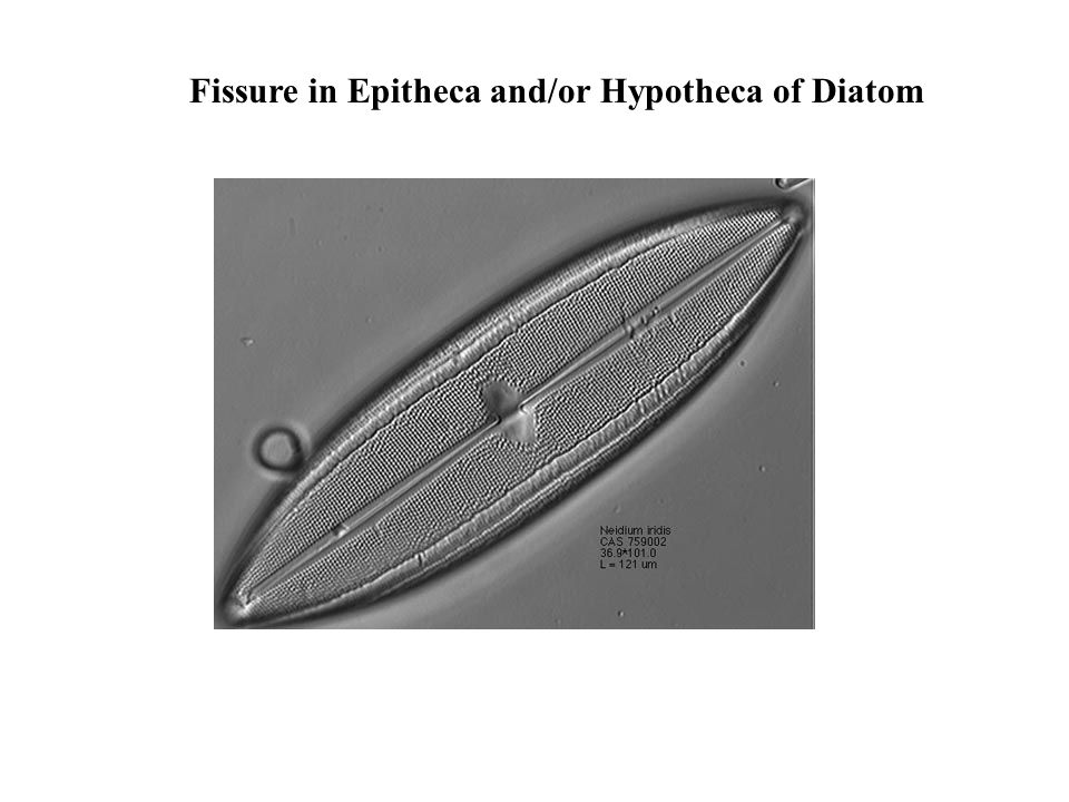Fissure in Epitheca and/or Hypotheca of Diatom