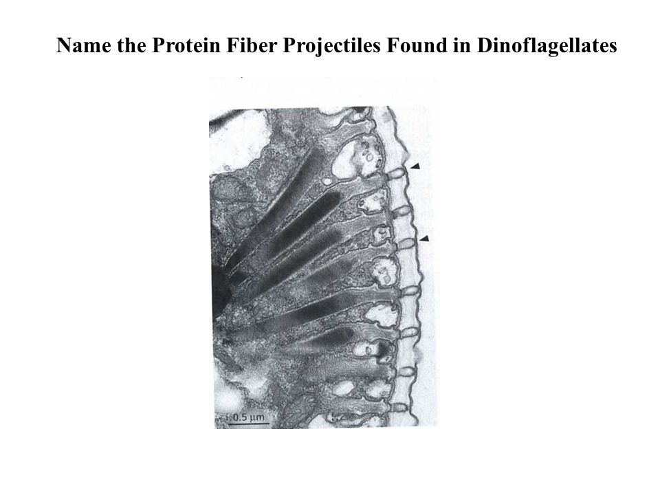 Name the Protein Fiber Projectiles Found in Dinoflagellates