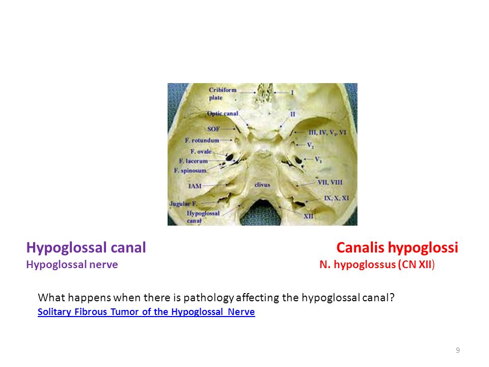 Optic canal Canalis opticus Optic nerve N. opticus CN (Cranial nerve) II  Opthalmic artery A. opthalmica What happens when there is pathology  affecting. - ppt download