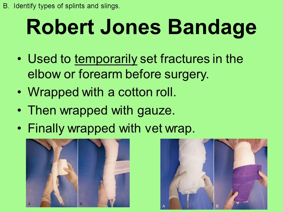 robert jones bandage