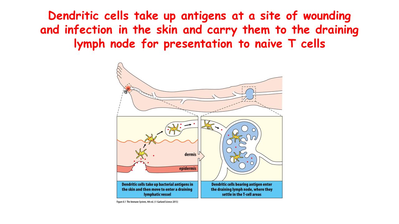 Dendritic cells take up antigens at a site of wounding and infection in the skin and carry them to the draining lymph node for presentation to naive T cells