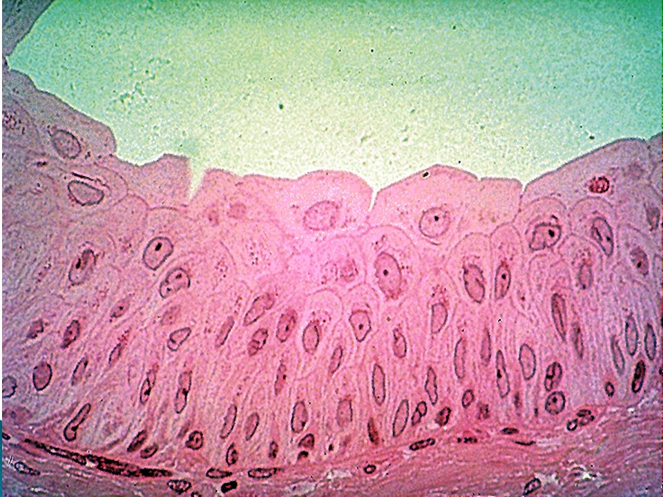 Клетки слизистой полости рта. Переходный эпителий уротелий. Переходный эпителий мочевого пузыря. Эпителий трахеи гистология. Уротелий мочевого пузыря гистология.