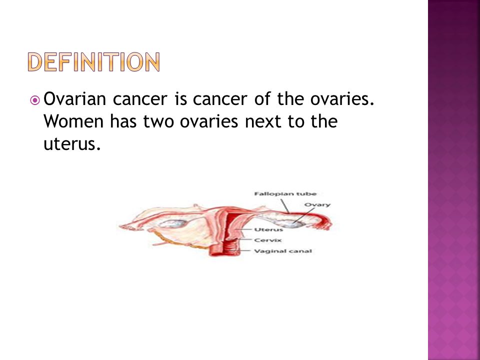 ovarian cancer definition intraductal papilloma in situ