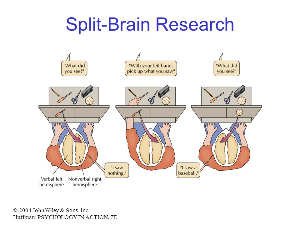 Split brain. Эксперимент Сперри. Газзанига расщепленный мозг. Эксперимент Сперри и Газзанига.