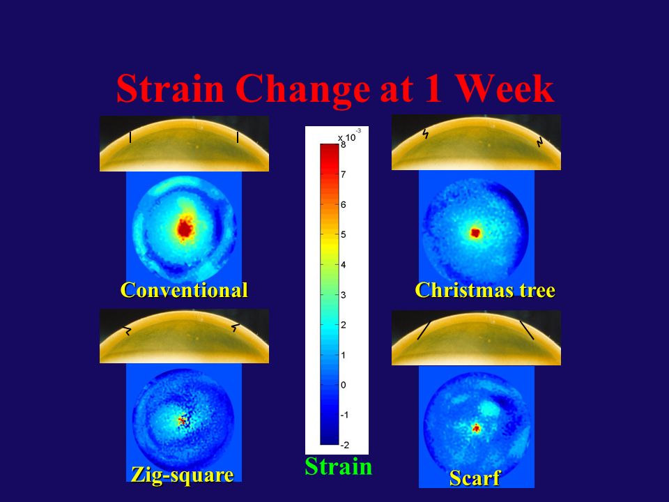 Conventional Christmas tree Scarf Zig-square Strain Change at 1 Week Strain