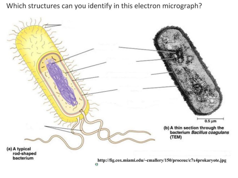 Draw And Label A Diagram Of The Ultrastructure Of Escherichia Coli E Ppt Download