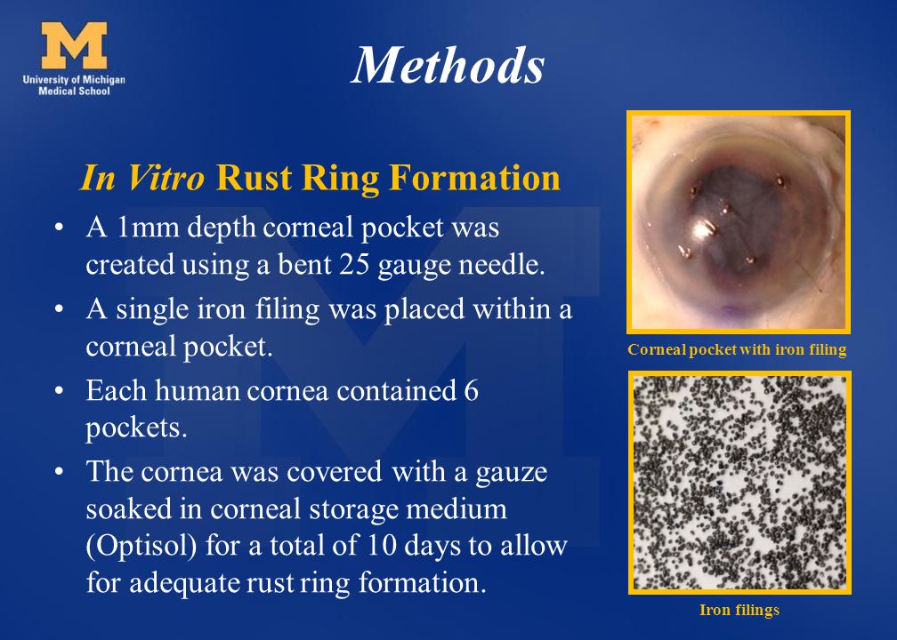 Comparison of Corneal Rust Ring Removal By Magnetic and Nonmagnetic Tipped  Burr Sejal R. Amin, MD Christopher T. Hood, MD Shahzad I. Mian, MD W. K.  Kellogg. - ppt download
