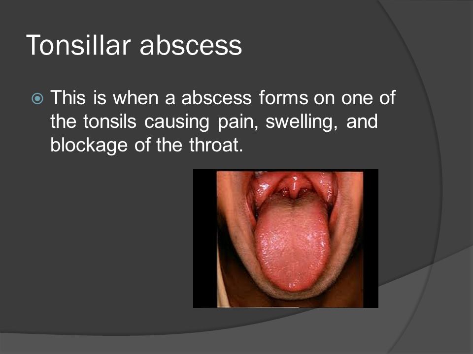 Can Oral Herpes Be Spread To Genitals
