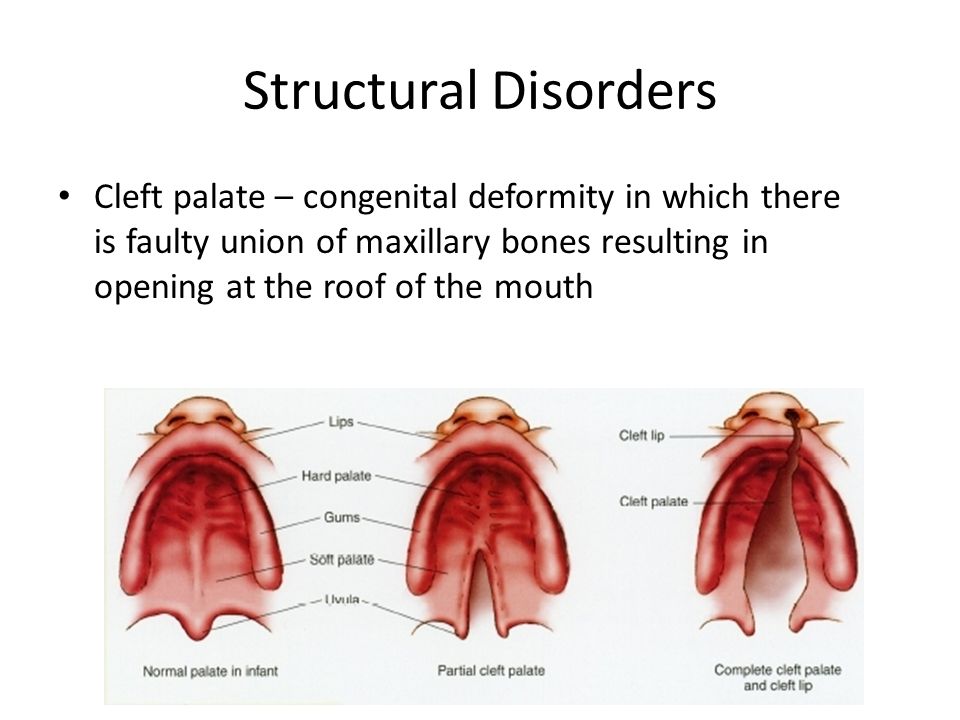 The Skeleton: Bones & Joints Chapter 7 Anatomy & Physiology I. -  ppt download