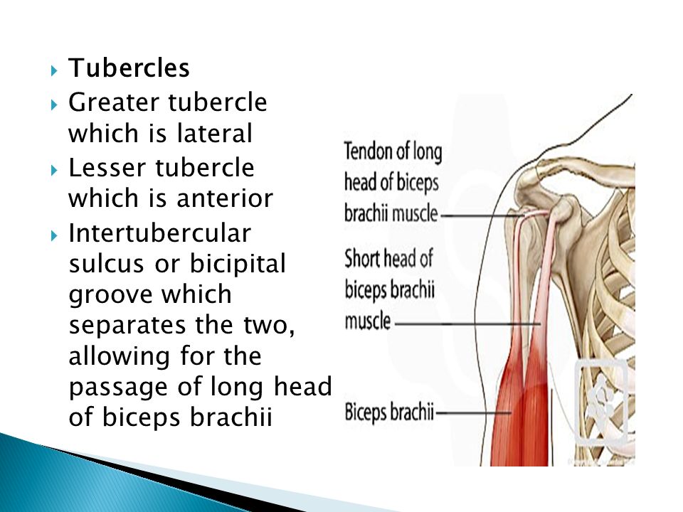  Tubercles  Greater tubercle which is lateral  Lesser tubercle which is anterior  Intertubercular sulcus or bicipital groove which separates the two, allowing for the passage of long head of biceps brachii