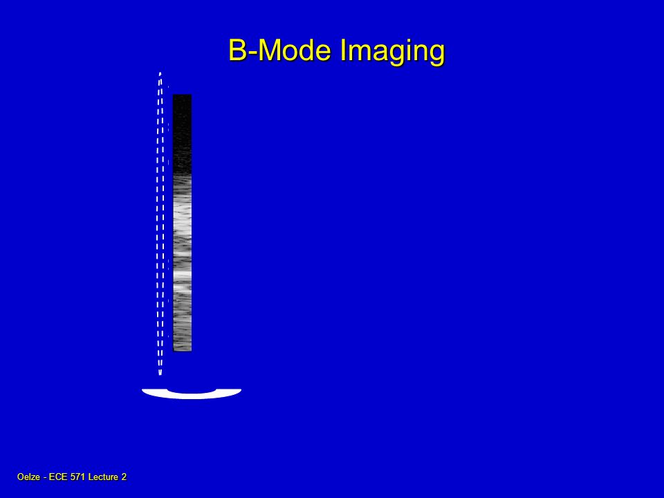 Oelze - ECE 571 Lecture 2 B-Mode Imaging