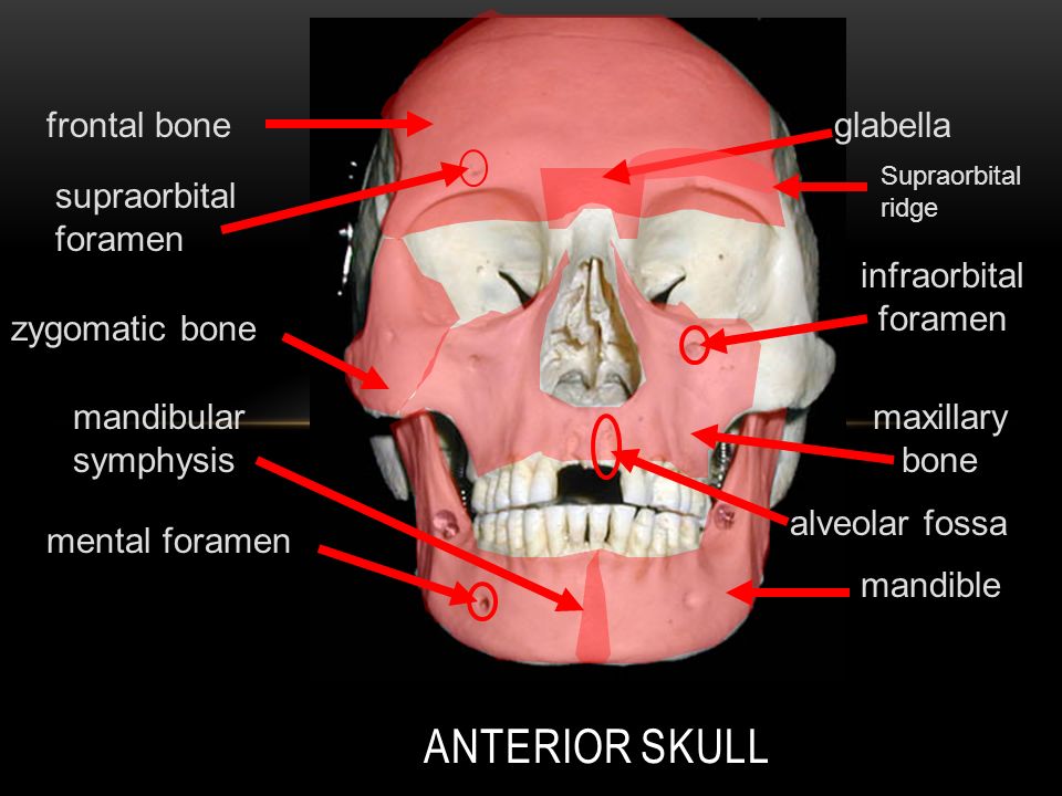 AXIAL SKELETON SKULL TUTORIAL. ANTERIOR SKULL frontal bone supraorbital  foramen zygomatic bone maxillary bone alveolar fossa infraorbital foramen  glabella. - ppt download