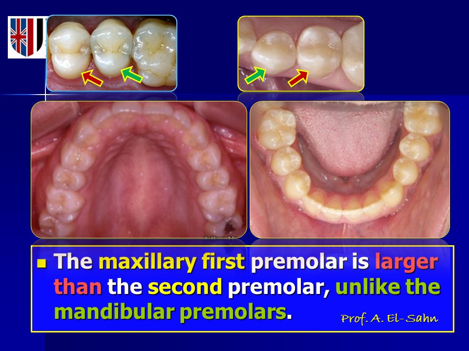 the maxillary first and second premolars are more alike than the mandibular premolars