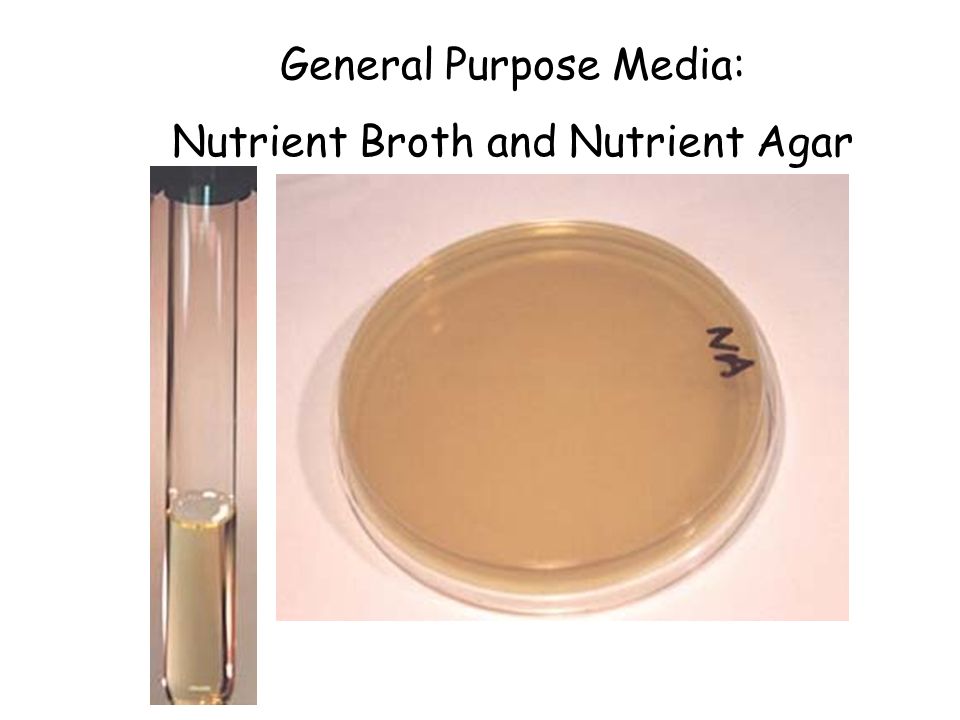 Image result for nutrient broth 