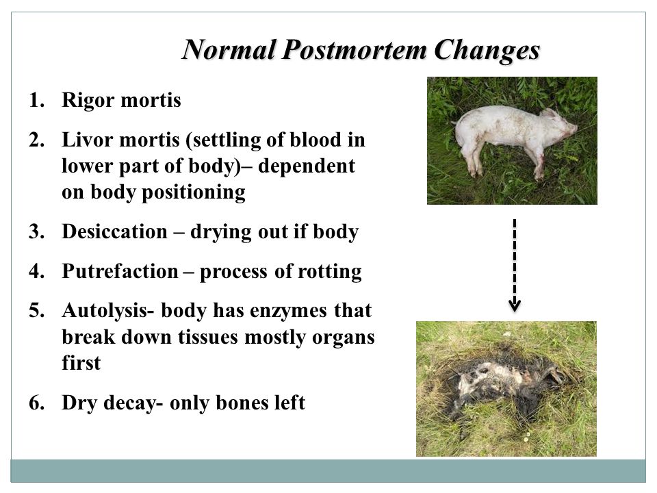 POSTMORTEM INVESTIGATION OF SUDDEN OR UNEXPECTED DEATH OR TRAUMA TO THE  LIVING Forensic Pathology. - ppt download