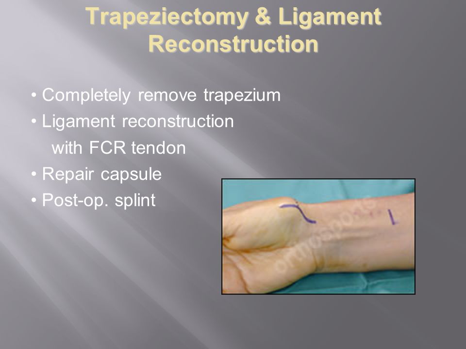 COMMON ORTHOPAEDIC CONDITIONS OF THE HAND AND WRIST Korsh Jafarnia
