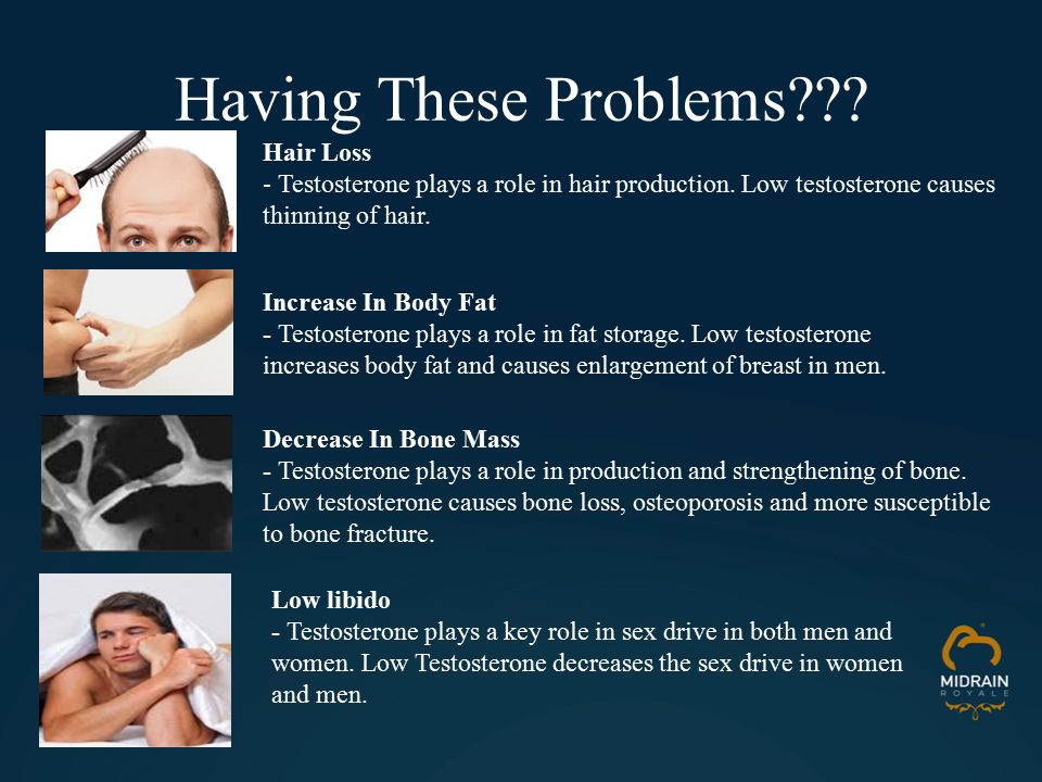 An Overview of the Causes of Baldness  Dihydrotestosterone DHT