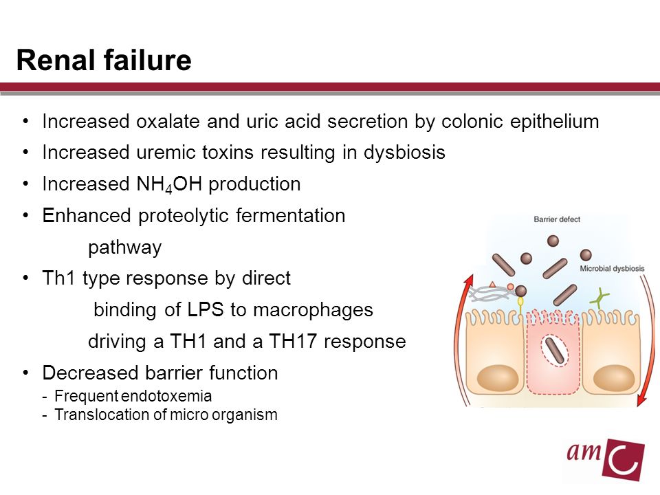 Renal failure Increased oxalate and uric acid secretion by colonic epithelium Increased uremic toxins resulting in dysbiosis Increased NH 4 OH production Enhanced proteolytic fermentation pathway Th1 type response by direct binding of LPS to macrophages driving a TH1 and a TH17 response Decreased barrier function -Frequent endotoxemia -Translocation of micro organism
