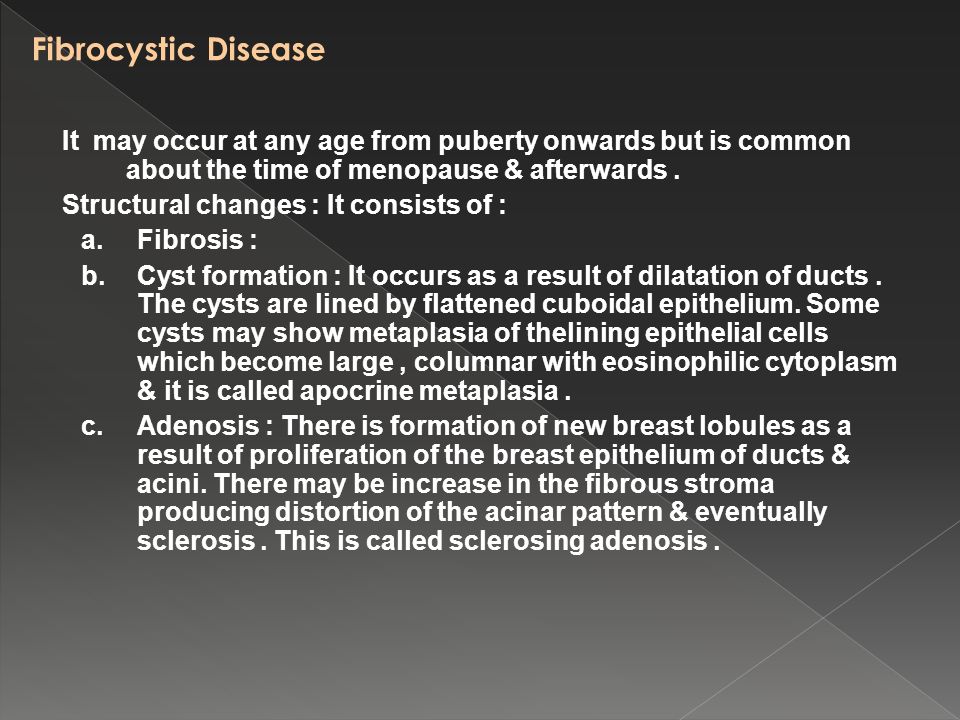 Fibrocystic Disease It may occur at any age from puberty onwards but is common about the time of menopause & afterwards.