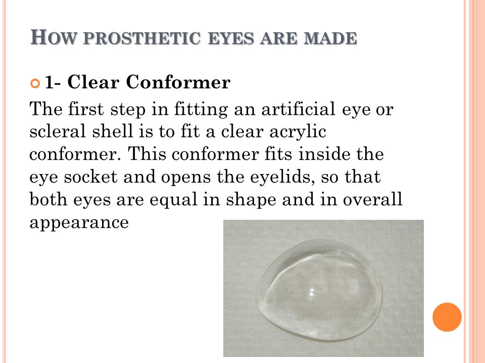 Prosthetic Eye (Artificial eye) - Aravind Eye Care System