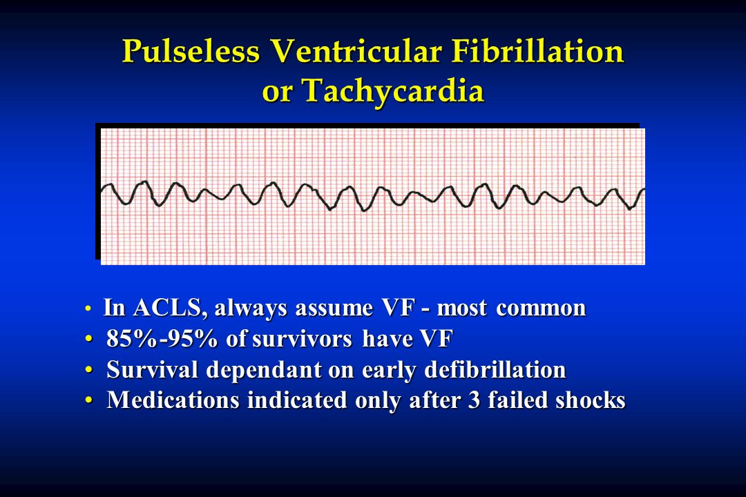 Pulseless Ventricular Fibrillation or Tachycardia In ACLS, always assume VF...