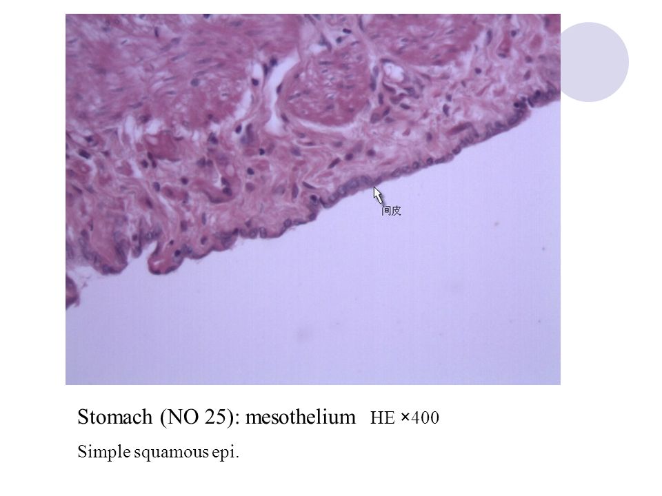Stomach (NO 25): mesothelium HE ×400 Simple squamous epi.