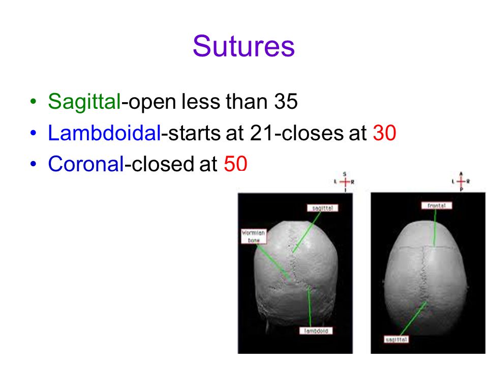 Sutures Sagittal-open less than 35 Lambdoidal-starts at 21-closes at 30 Coronal-closed at 50