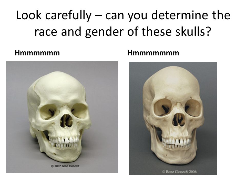 How To Identify Race From Skull