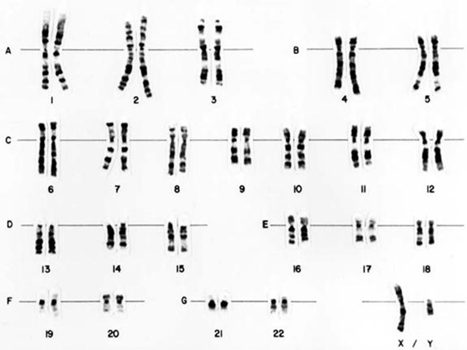 Геном генотип кариотип. Кариотип 46 XY(11). Графическое изображение кариотипа. Кариотипы животных и растений. Изменение числа отдельных хромосом