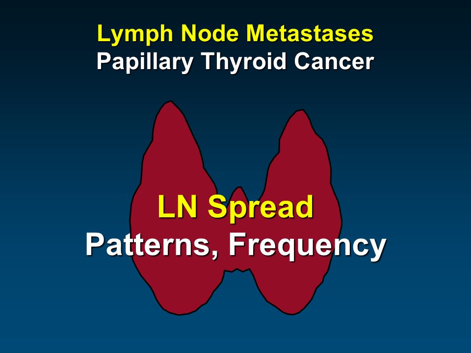 Lymph Node Metastases Papillary Thyroid Cancer LN Spread Patterns, Frequency