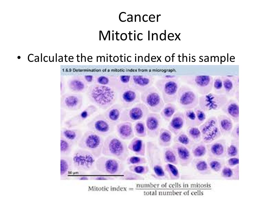 mitotic index example Mitotic index | bioninja.