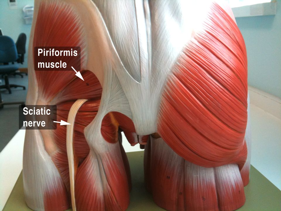 Грушевидная Piriformis