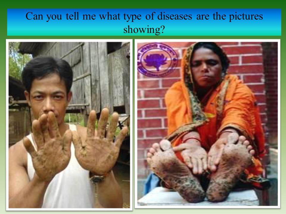 Can you tell me what type of diseases are the pictures showing
