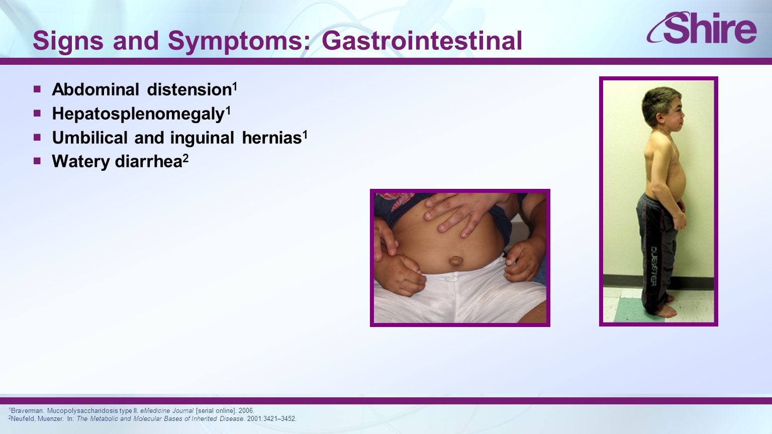 Signs and Symptoms: Gastrointestinal  Abdominal distension 1  Hepatosplenomegaly 1  Umbilical and inguinal hernias 1  Watery diarrhea 2 1 Braverman.