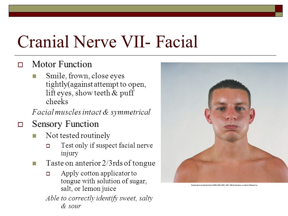craniel nerves vii facial Craniel nerves vii facial