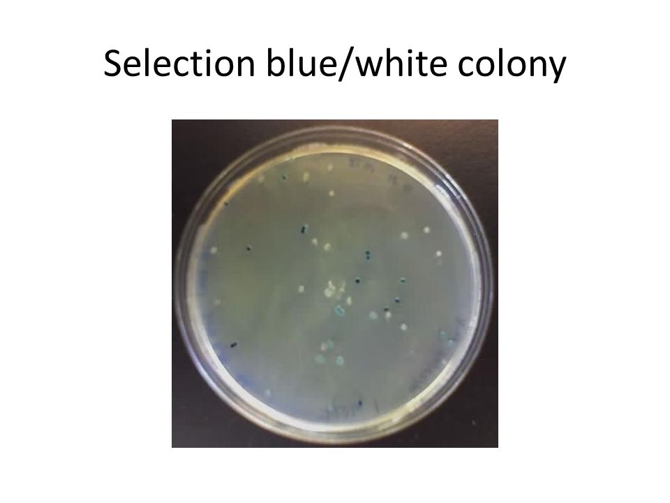Selection blue/white colony