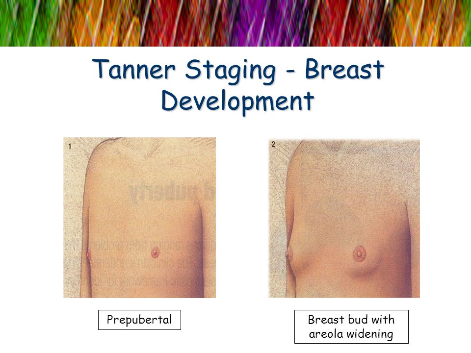 Tanner Naked