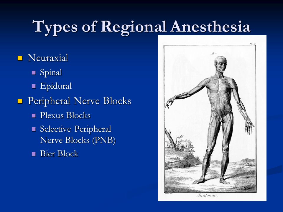 Perioperative Regional Anesthesia A practical approach November 7, 2015  Gareth Nakasone, MD. - ppt download