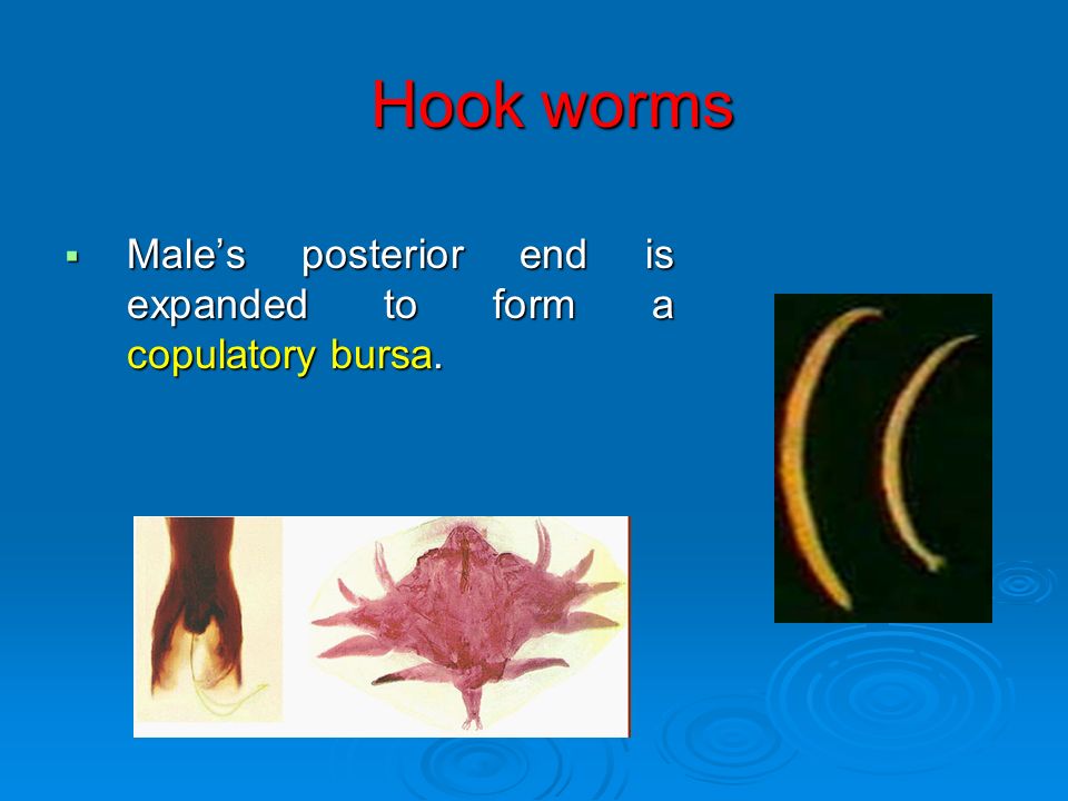Hook worms. 1. Ancylostoma duodenale 2. Necator americanus A